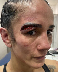 Amanda Serrano Retaliates and Says Katie Taylor Continued to Headbutt Her Illegally